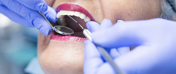 Best Emergency Root Canal Treatment in Lochbuie, CO